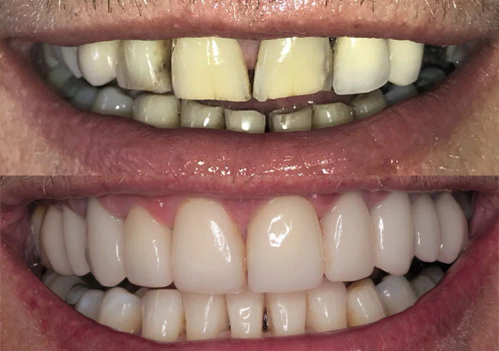 Smile Makeover case study image