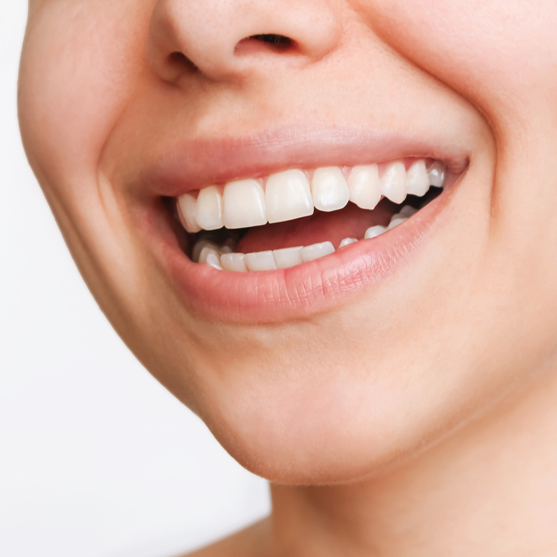 Healthy teeth and gums