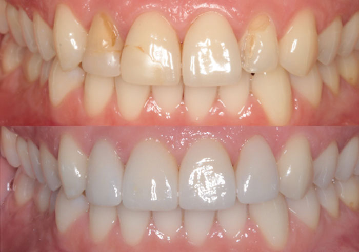 Case study 1