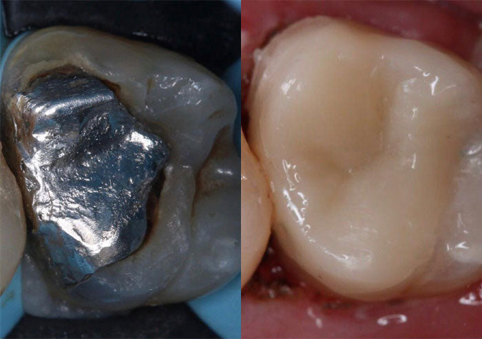Case Study 13