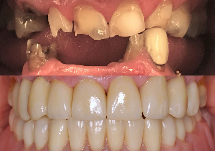 Case Study 8