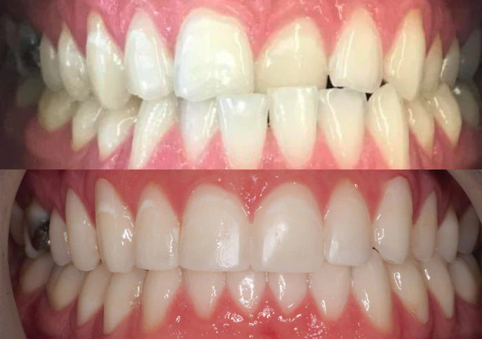 Smile Makeover case study image
