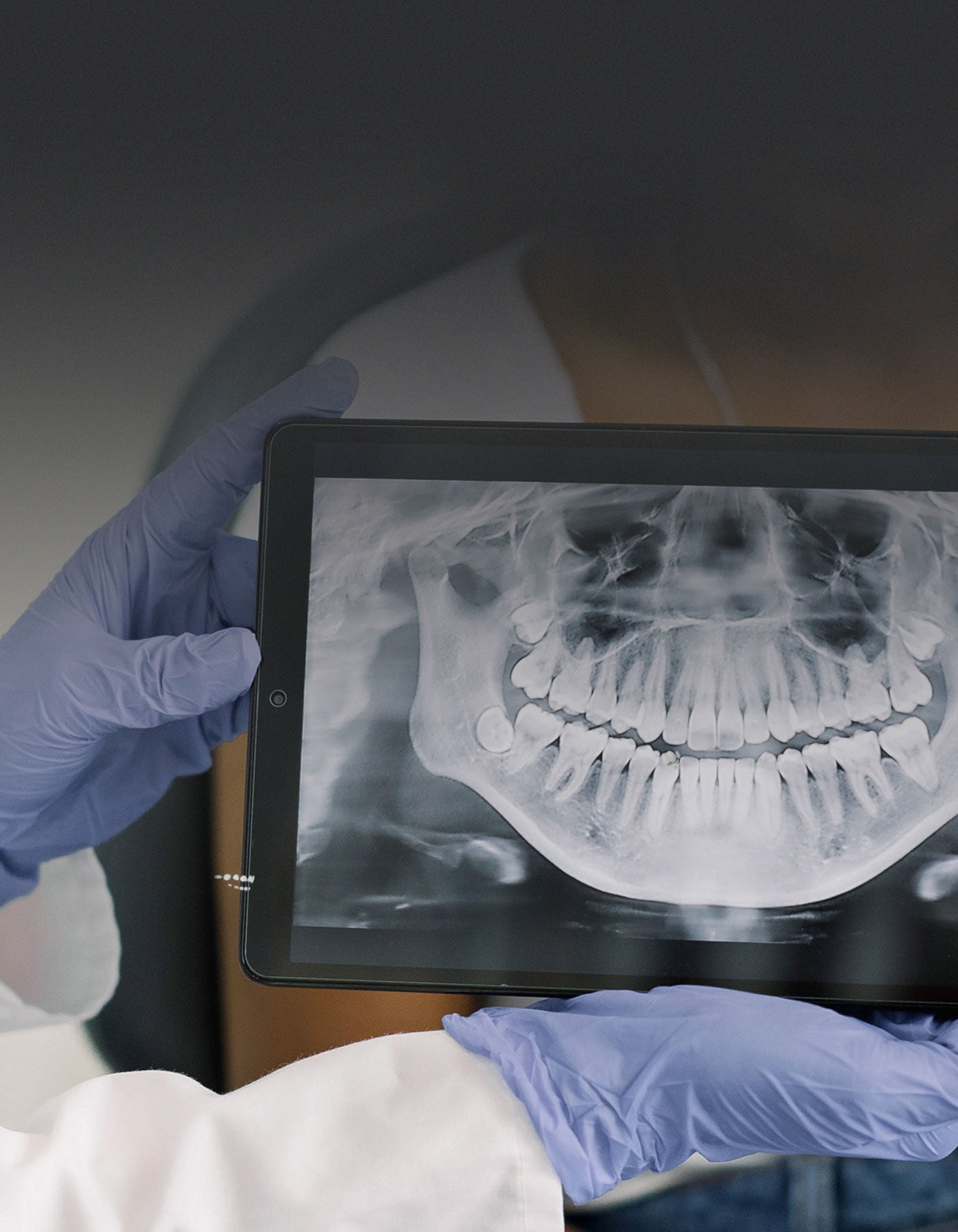 Patient having dental examination looking at dental x-ray