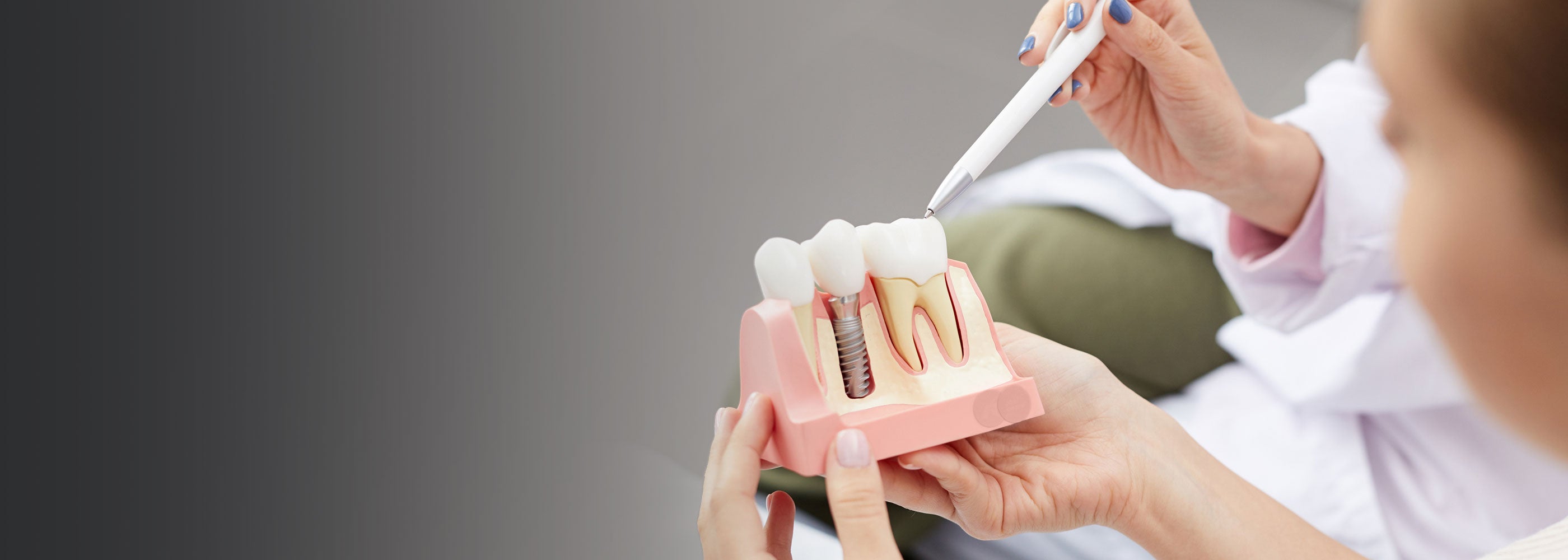 Dental implant