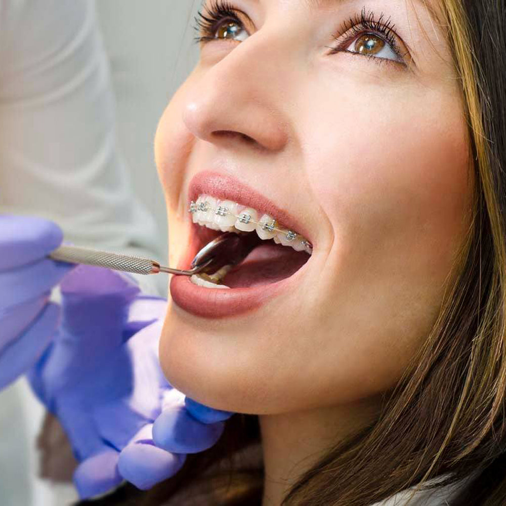 A patient wearing orthodontic braces